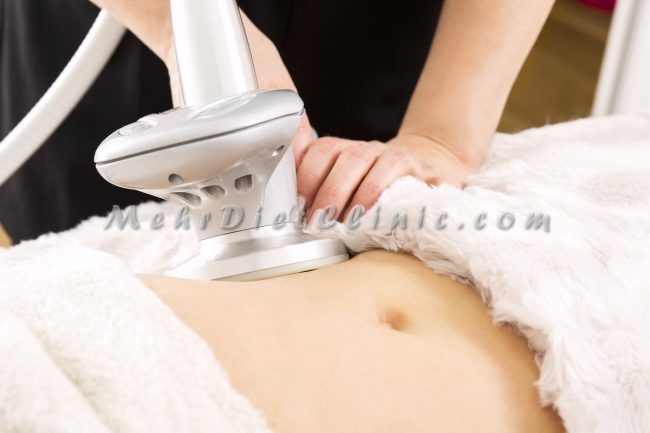 دستگاه لاغری دستگاه لاغری