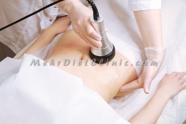 دستگاه لاغری شمال تهران