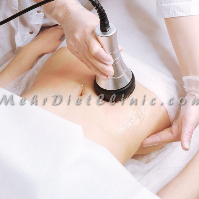 دستگاه لاغری شمال تهران