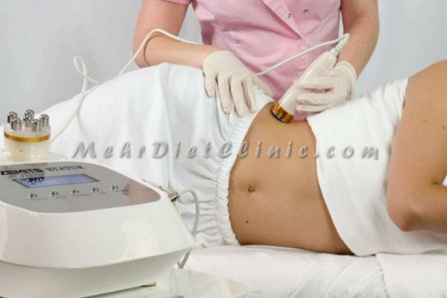 دستگاه لاغری موضعی دستگاه لاغری موضعی