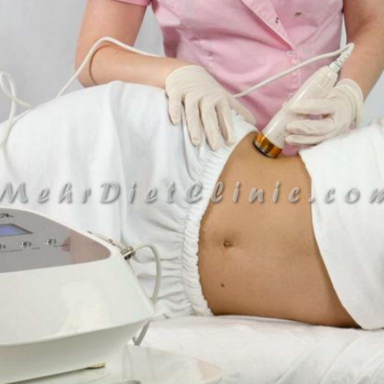 دستگاه لاغری موضعی