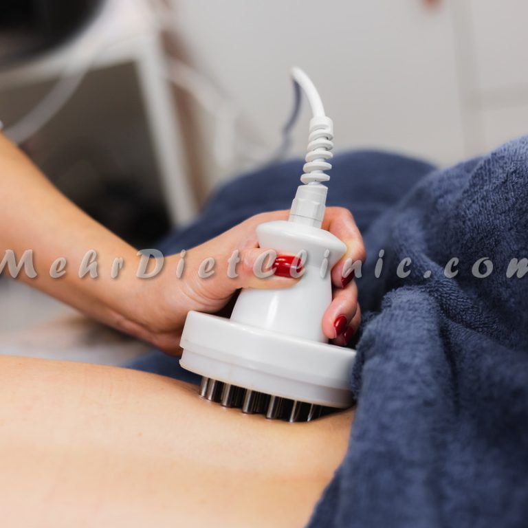 دستگاه لاغری موضعی