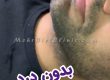 دستگاه لاغری و جوانسازی پوست صورت