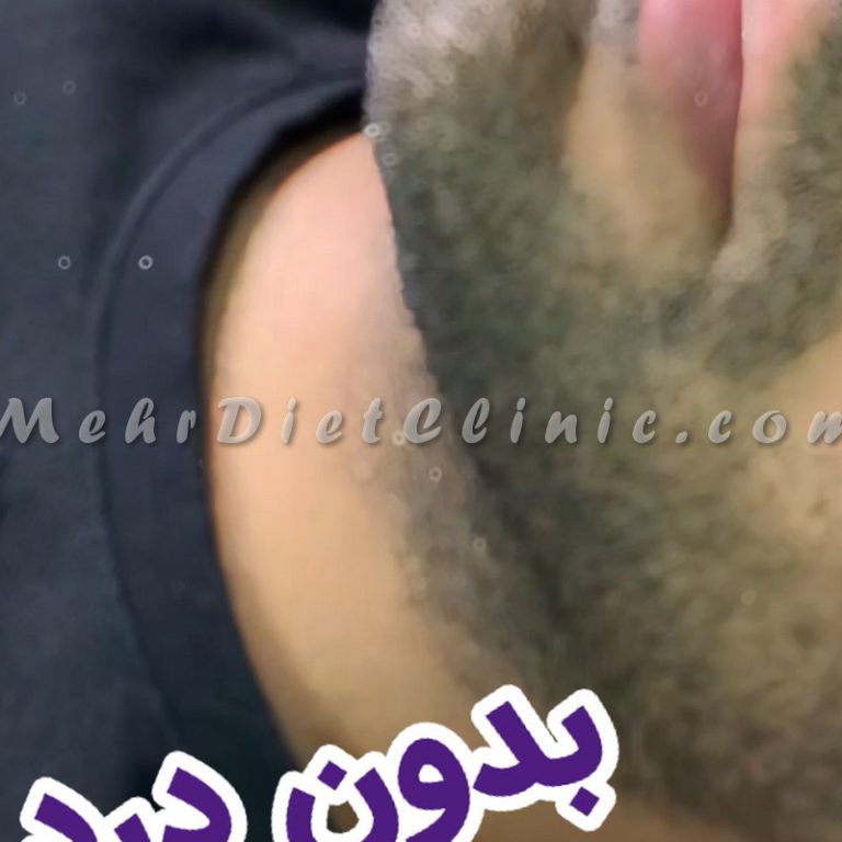 دستگاه لاغری و جوانسازی پوست صورت