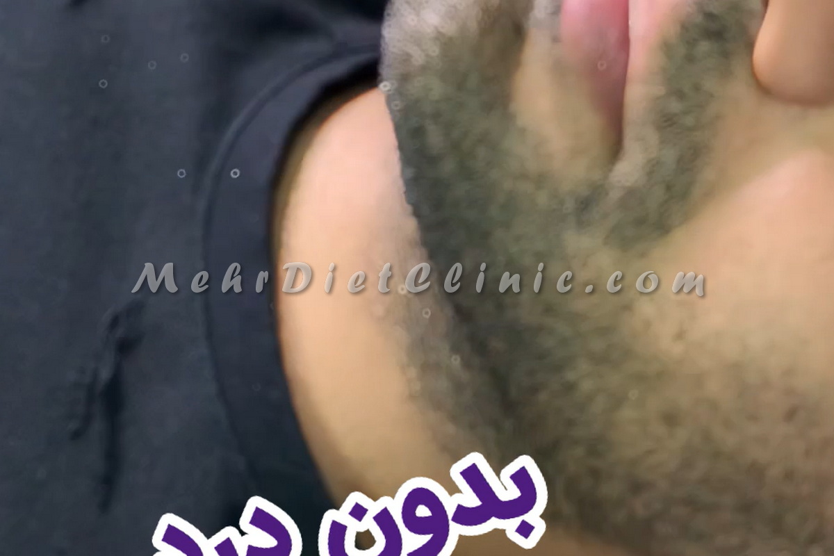 دستگاه لاغری و جوانسازی پوست صورت