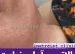 رضایت 100% مشتریان کلینیک لاغری مهر