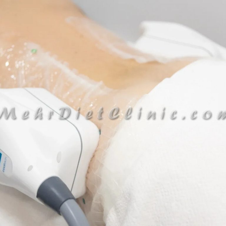 دستگاه لاغری منطقه 2