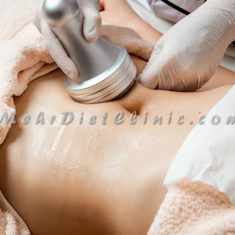 کاهش سایز موضعی با دستگاه لاغری