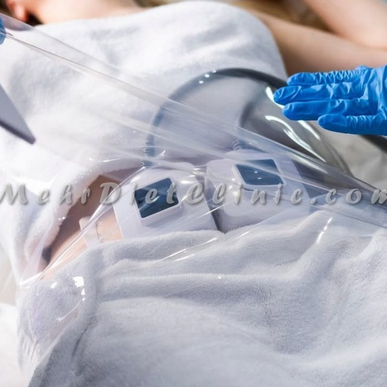 دستگاه لاغری ساکشن و روتیشن ترواسکالپ TruSculpt