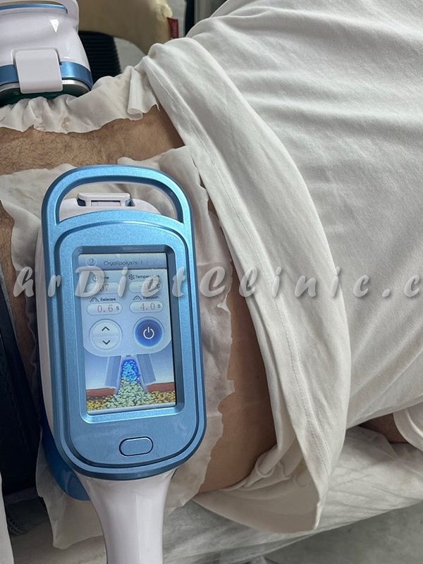 بهترین دستگاه لاغری موضعی شکم و پهلو (6) بهترین دستگاه لاغری موضعی شکم و پهلو (6)