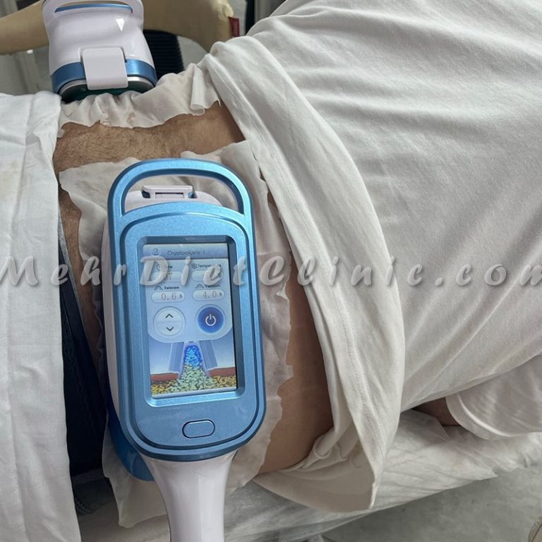 بهترین دستگاه لاغری موضعی شکم و پهلو (6)